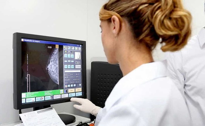 Câncer de mama tem primeira imunoterapia aprovada no Brasil