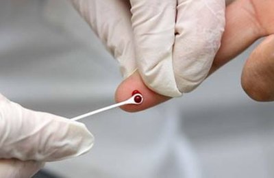 Por meio do Cespi, Palmeira realiza mais de 1.800 testes rápidos para identificar Hepatites B e C