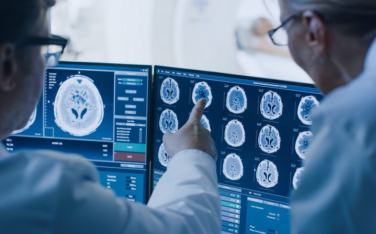 Nova técnica permite diagnosticar o Alzheimer com precisão