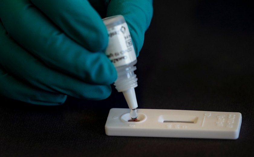 75% dos testes de coronavírus importados pelo Brasil são pouco confiáveis e podem falhar