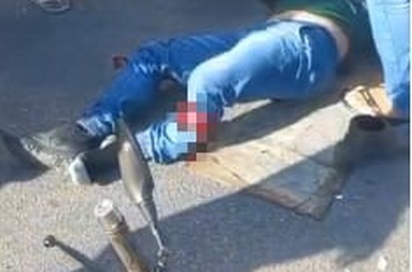 Motociclista sofre fratura exposta após colisão com caminhão em Rio Largo