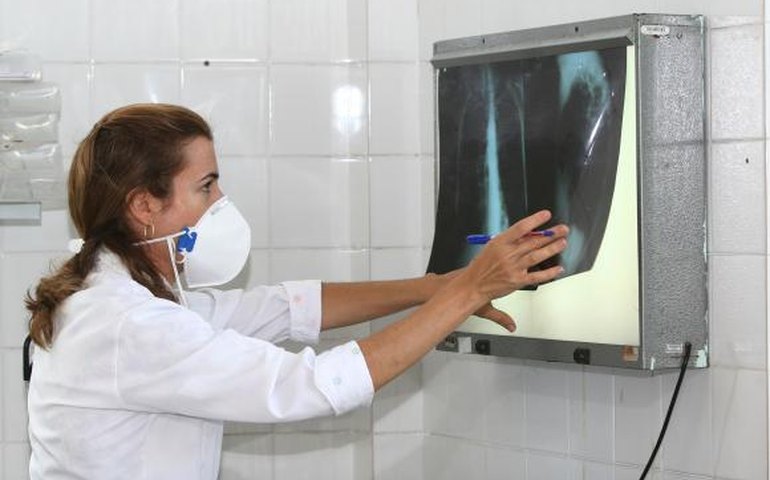 Campanha de Combate à Tuberculose intensifica prevenção à doença em Maceió
