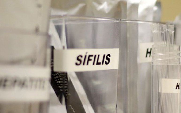 Sífilis continua em ritmo acelerado de crescimento no país