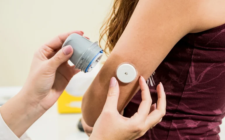 Justiça de Alagoas obriga Hapvida a custear sensor de glicose para criança com diabetes