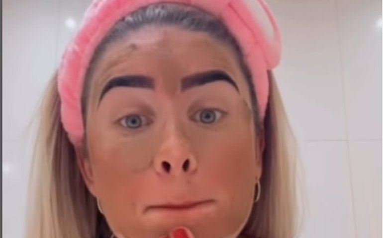 Fezes no rosto: dermatologista explica quais são os riscos do tratamento facial que viralizou