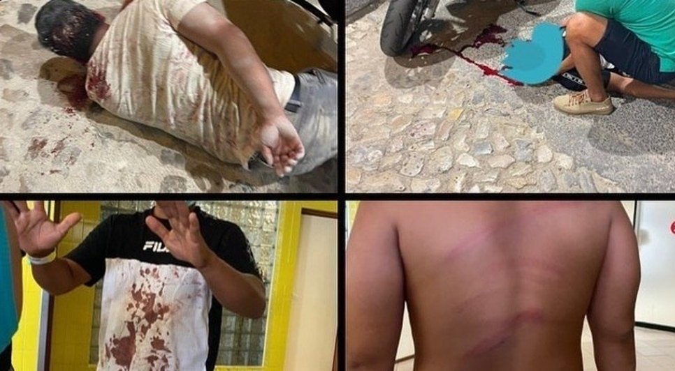 agressao-boate-portugal-10082022190737343 / Foto: REPRODUÇÃO FACEBOOK/GISLAINE ROSA