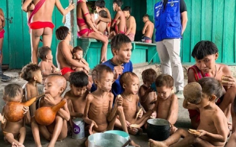 Tragédia Yanomani: ‘Crianças estão desnutridas de malária, diarreia, verme’