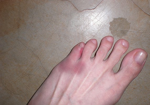 Polícia identifica suspeito de matar homem por pisar em seu pé