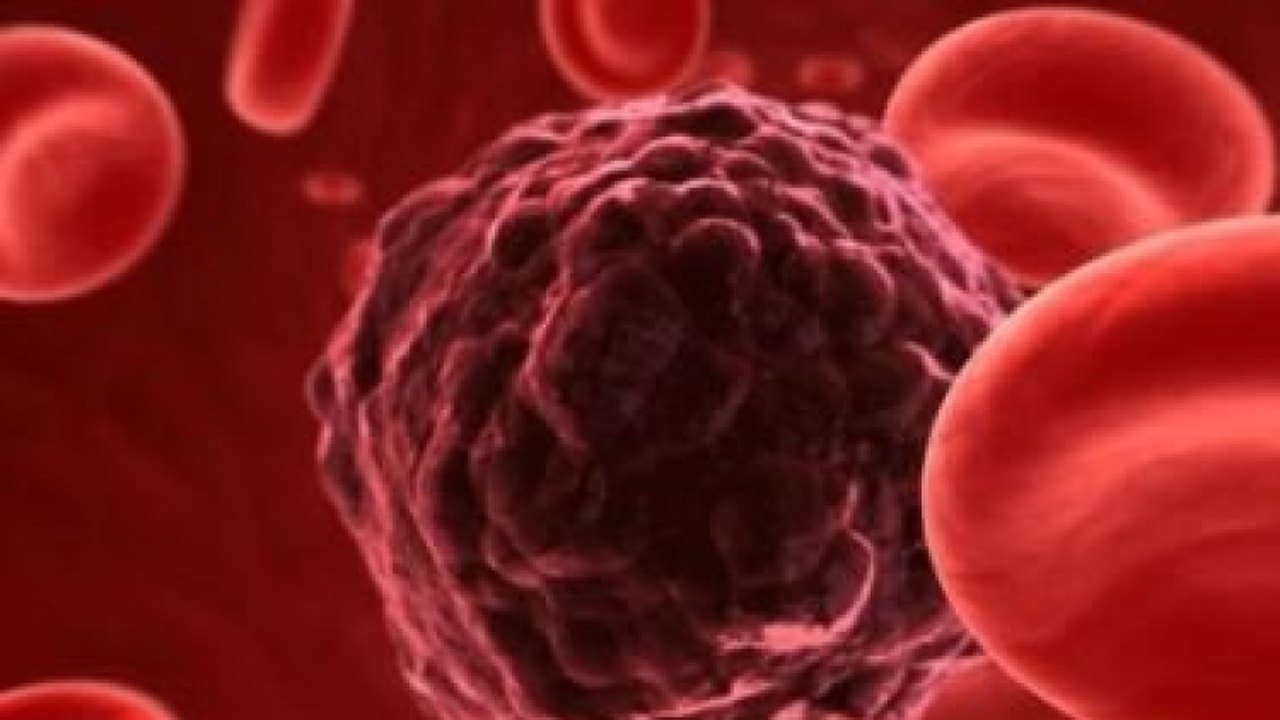 Novo tratamento pode curar 85% dos casos de câncer no sangue