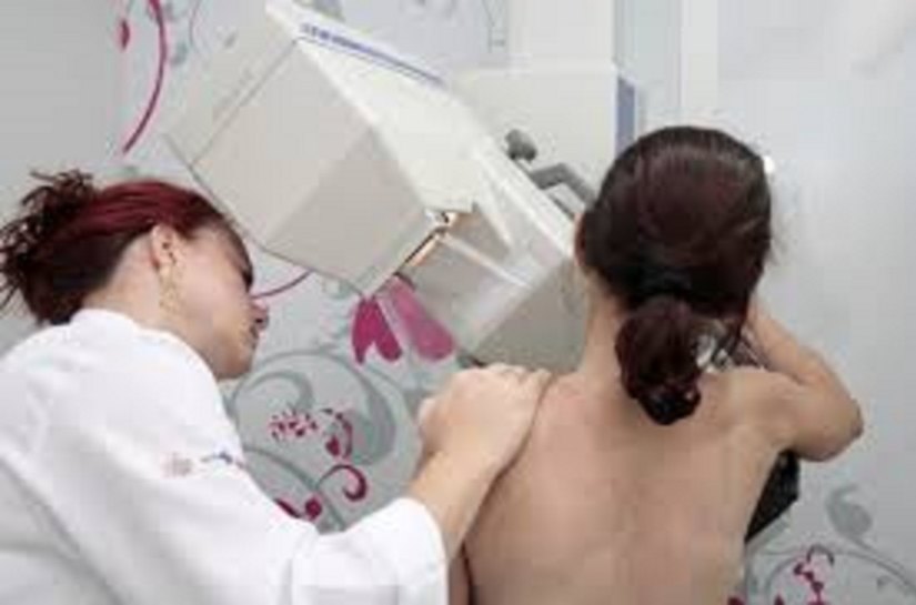 SMS orienta mulheres onde fazer mamografia e Papanicolau