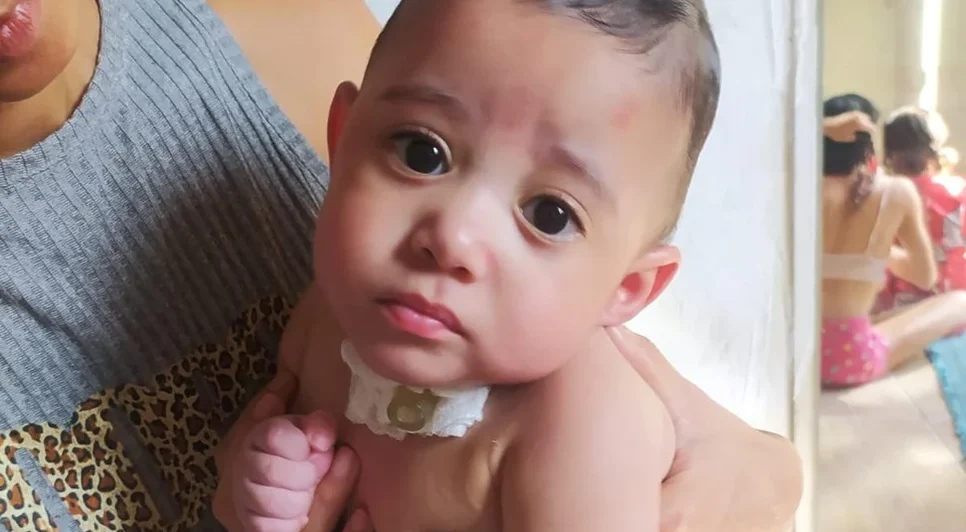 Richard Gabriel tinha 11 meses e microcefalia; mãe relata que o bebê morreu no dia seguinte à troca de uma sonda no HGE. - Foto: Arquivo pessoal