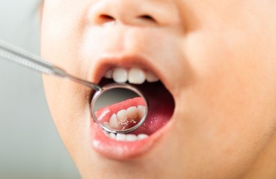 Saúde bucal infantil: 5 dicas para começar os cuidados desde cedo