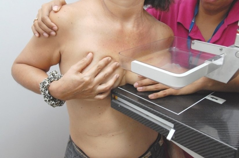 Sesau encerra Outubro Rosa com capacitação para acadêmicos