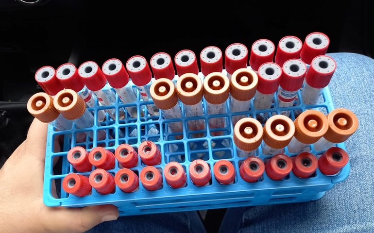 Adeal inicia coleta de amostras para identificar influenza aviária e doença de Newcastle