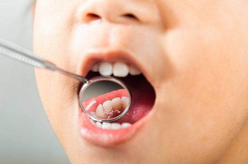 Saúde bucal infantil: 5 dicas para começar os cuidados desde cedo