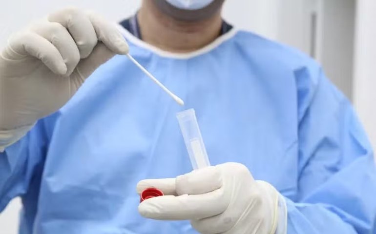 Mpox X varíola do macaco: há diferença entre elas?