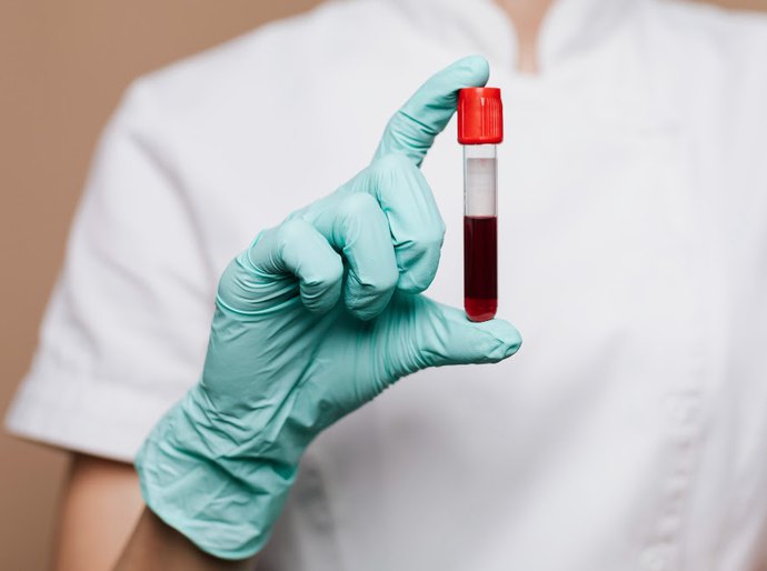 Startup usa IA para interpretar 20 mil hemogramas em busca de doenças graves no sertão pernambucano