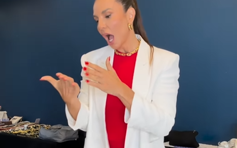 Ivete compartilha recepção calorosa das filhas após cirurgia no rosto