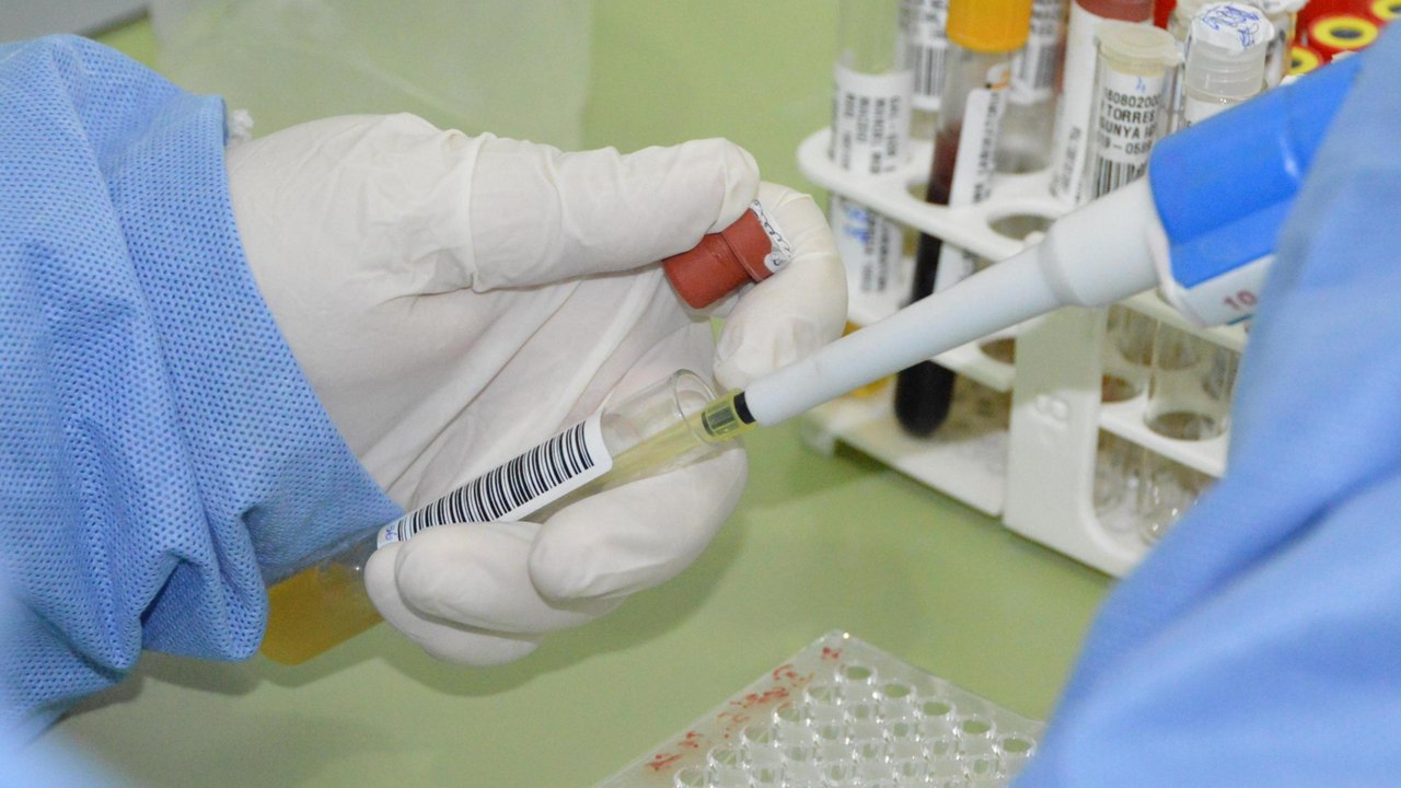 Sesau orienta população sobre riscos, prevenção e tratamento da doença de Chagas