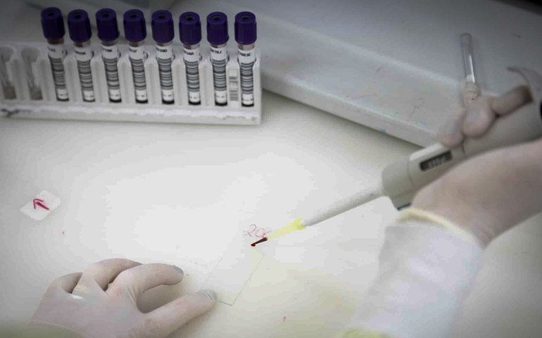Paciente com suspeita de ebola em SP testa positivo para meningite