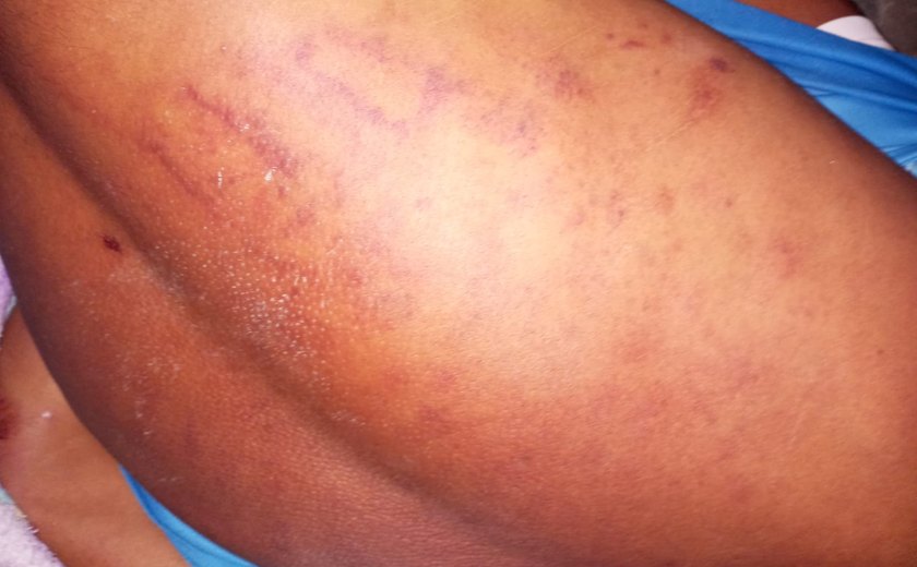 Polícia Civil vai investigar denúncia de violência envolvendo guarda municipal em São José da Laje