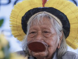 Cacique Raoni apresenta melhora, mas segue internado na UTI