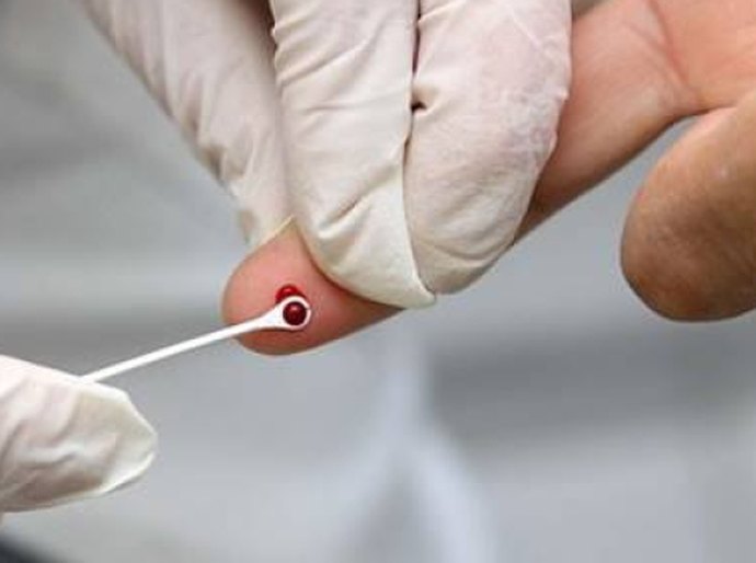 Por meio do Cespi, Palmeira realiza mais de 1.800 testes rápidos para identificar Hepatites B e C