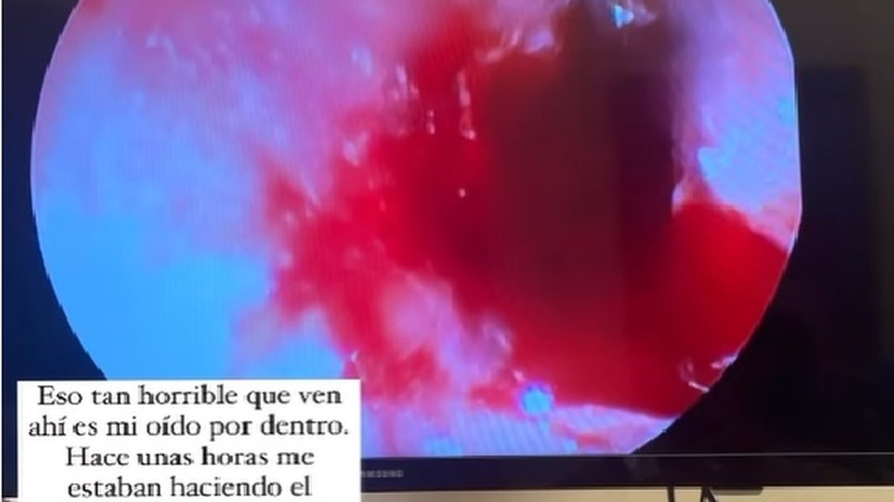 Anahí sofre perfuração no tímpano cinco meses antes da turnê 'Soy Rebelde'