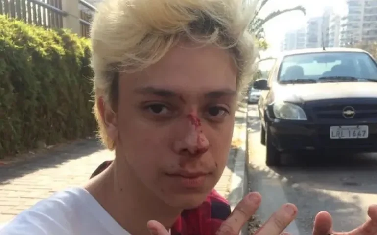 Victor Meyniel é agredido no Rio e alega homofobia; polícia prende agressor