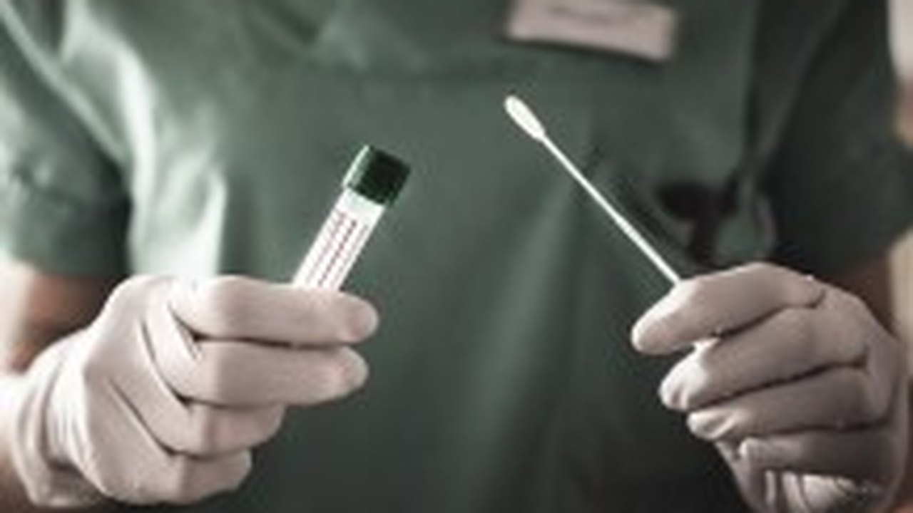 SP adquire 725 mil novos testes para covid-19; meta é zerar fila de testagem