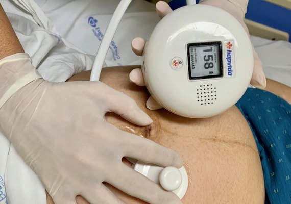 Hapvida NotreDame Intermédica e Senai Ceará lançam detector de frequência cardíaca fetal com Inteligência Artificial