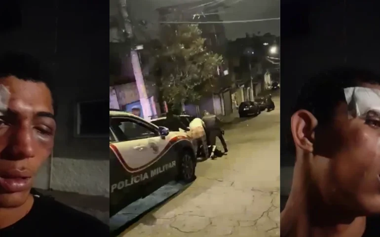 Jovem negro é agredido por PMs em abordagem na zona sul de SP