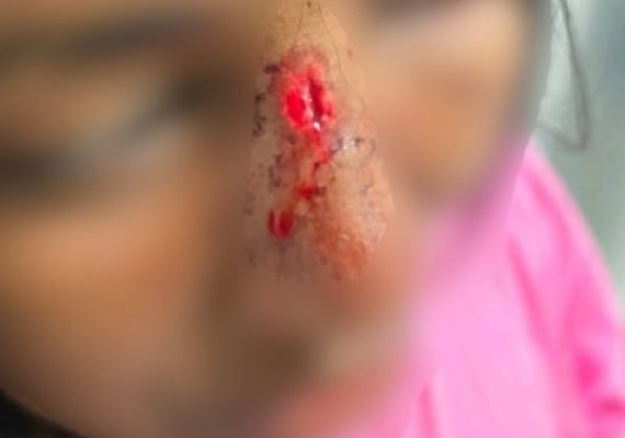 Homem é preso após espancar companheira com chutes na cabeça em Campo Alegre