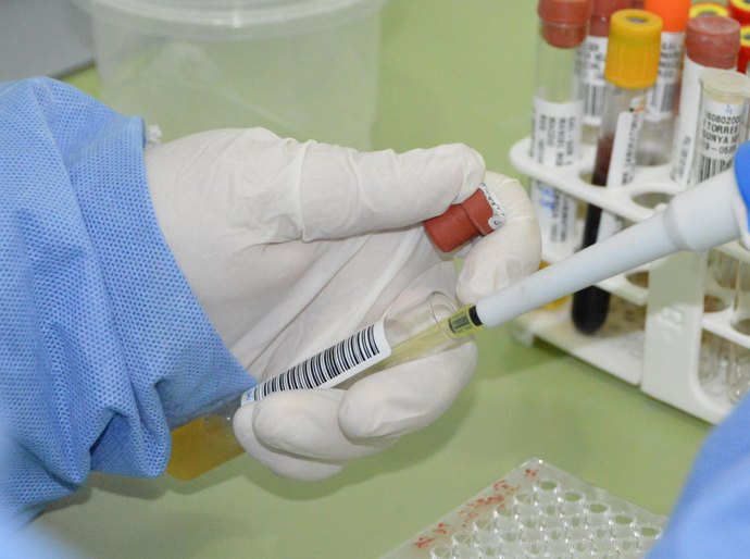 Sesau orienta população sobre riscos, prevenção e tratamento da doença de Chagas