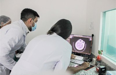 Programa 'AVC Dá Sinais' realiza primeira trombectomia mecânica em paciente alagoana. 