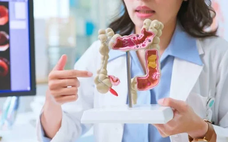 Câncer colorretal: informação e prevenção são aliados no diagnóstico precoce