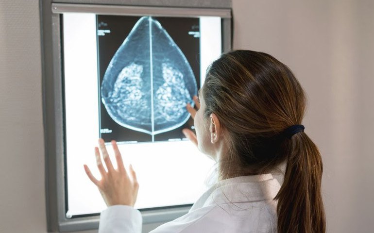 SUS amplia acesso à mamografia a mulheres de 40 a 49 anos