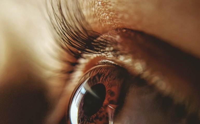 Cirurgia de catarata pode diminuir dependência de óculos