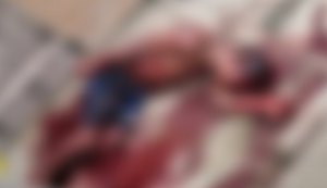 Homem espancado por suspeita de roubo. Fonte: Internet
