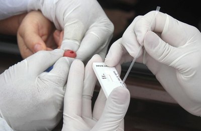 Covid-19: nova etapa de pesquisa de testagem da população começa na quinta-feira  em Maceió