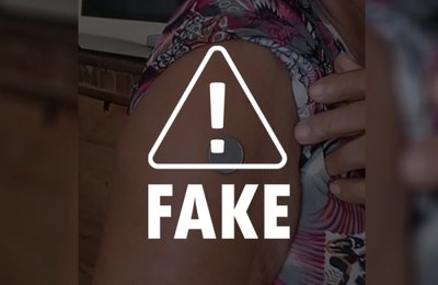 É falso que vacinas provoquem “efeito imã” na pele