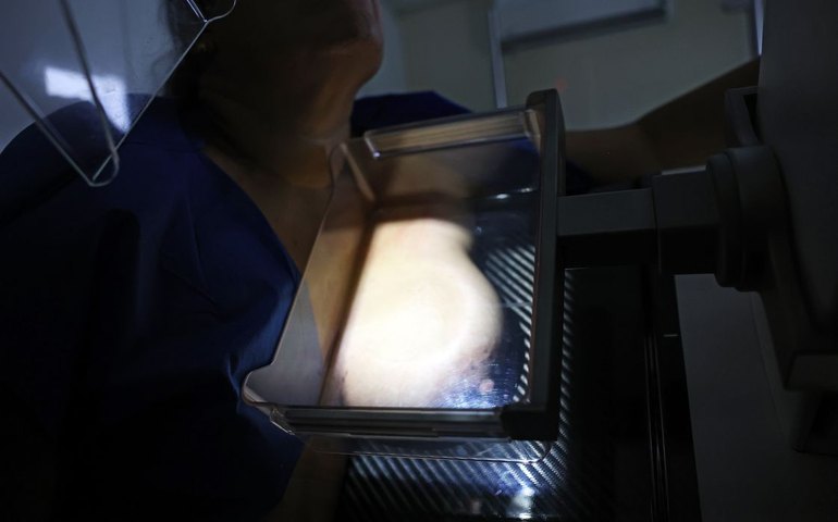 Campanha do MS busca aumentar diagnóstico precoce do câncer de mama