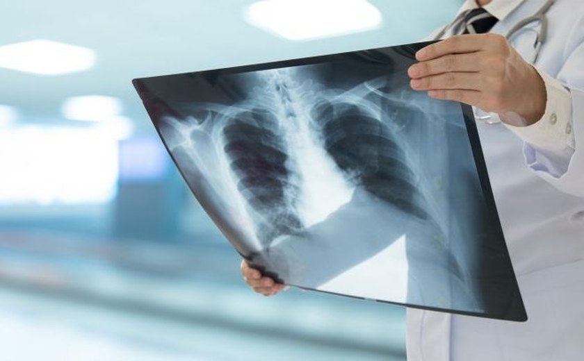 Projeto facilita redirecionamento de emendas parlamentares na área de saúde no Orçamento de 2025