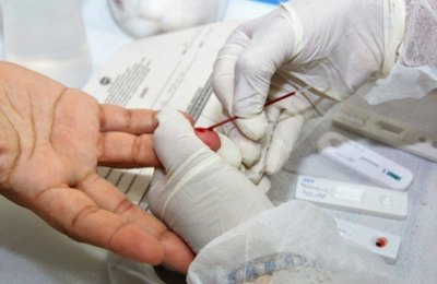 Sesau lança campanha para estímulo à testagem rápida de HIV