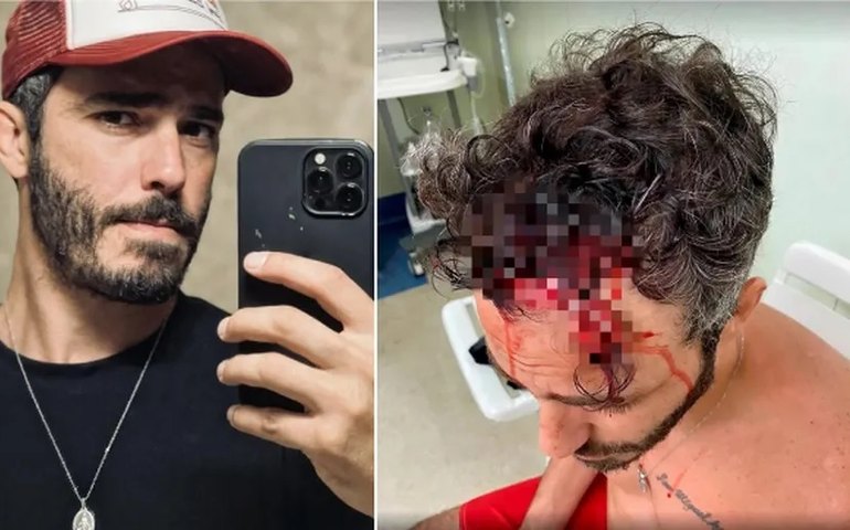 Ator Thiago Rodrigues caiu sozinho e não sofreu assalto no Rio, conclui Polícia