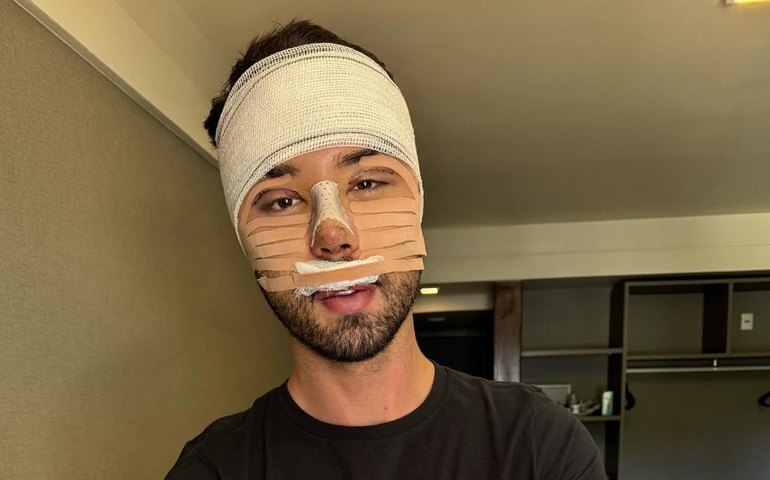 Rico Melquíades diz ter feito cirurgias plásticas após haters o chamarem de 'feio'