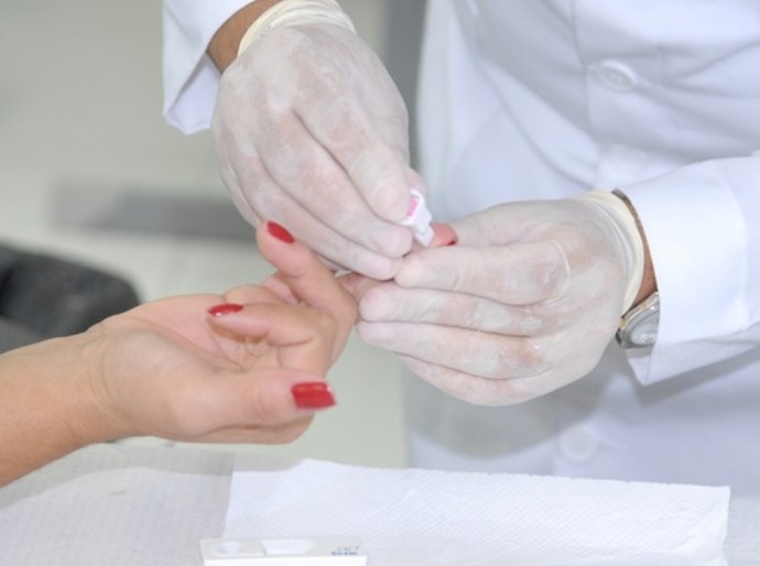 Ampliação de testes rápidos de HIV aumenta diagnósticos de Aids em AL