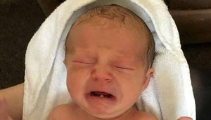 Bebê nasce com dente / Foto: Reprodução Daily Mail