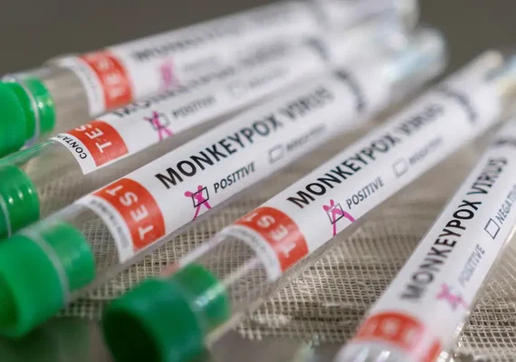 Mpox: onde fazer o teste para a doença no Brasil e quais os sintomas de alerta? Médicos explicam
