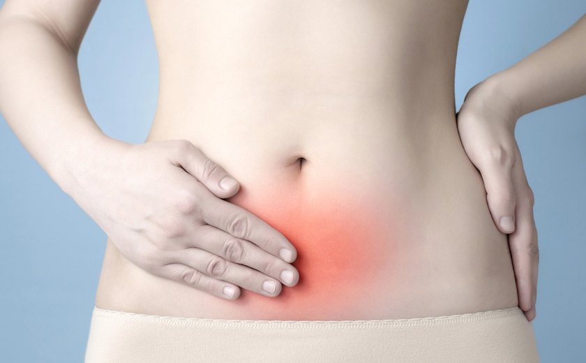 Fortes cólicas menstruais podem indicar endometriose